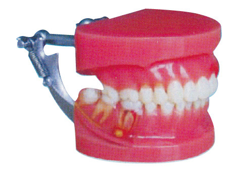 Red and White Periodontal Disease Demonstration Human Teeth Model General Doctor