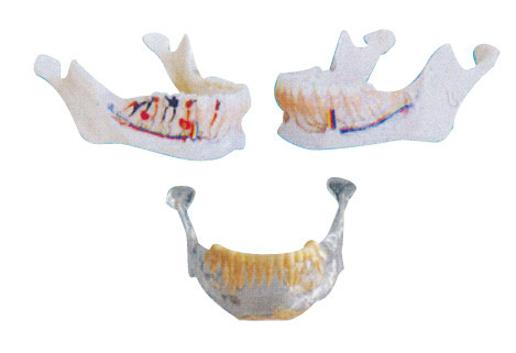 Dentist teeth model Mandibular Model with Nerves , Arteries and Veins