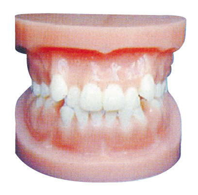 Dental implant models / Orthodontic Model for Anatomical Training