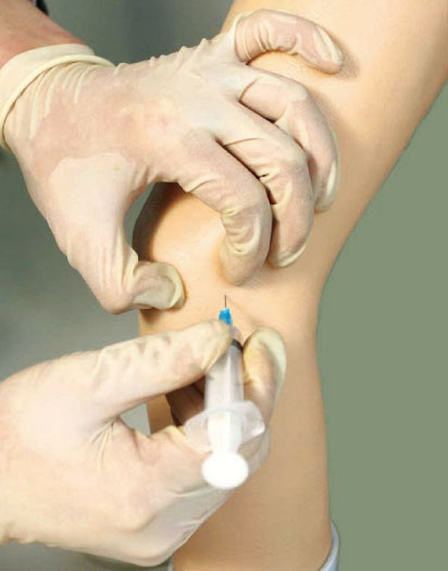 electronic elbow joint intracavitary injection clinic