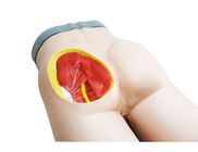 Nursing PVC Contrastive Intramuscular Injection Buttocks