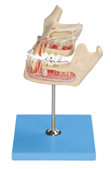 Pathologic Human Teeth Model / Jaw Model with Color Matching by Computer about Two Parts