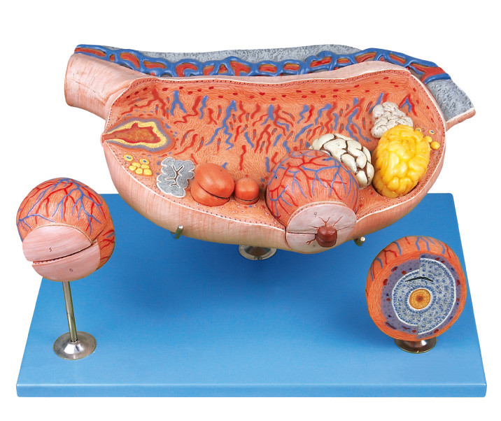 8 parts Enlarged Ovary  Human  Anatomy Model  shows ovarian follicles,ovium,ovulation ,ovum