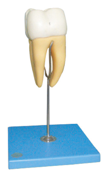 16 Times Life Size Of Molar Model For Hosiptals And Medical Schools Training