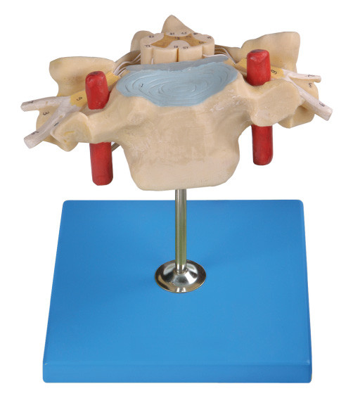 Cervical Vertrebra with Spinal cord  Human Anatomy model shows spinal artery,vein ,nerve