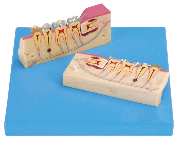 12 Positions are Displayed of Dissected Model of Teeth TIssue