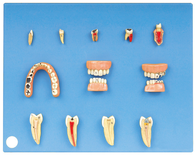 Dental Diseases Model Made of Advanced PVC For Internship And Students Training