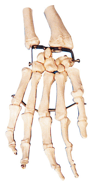 Palm Bone  Human Anatomy model training model for medical school