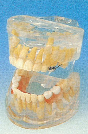 Dental Schools Human Teeth Model / Transparent Milk Teeth Development Model