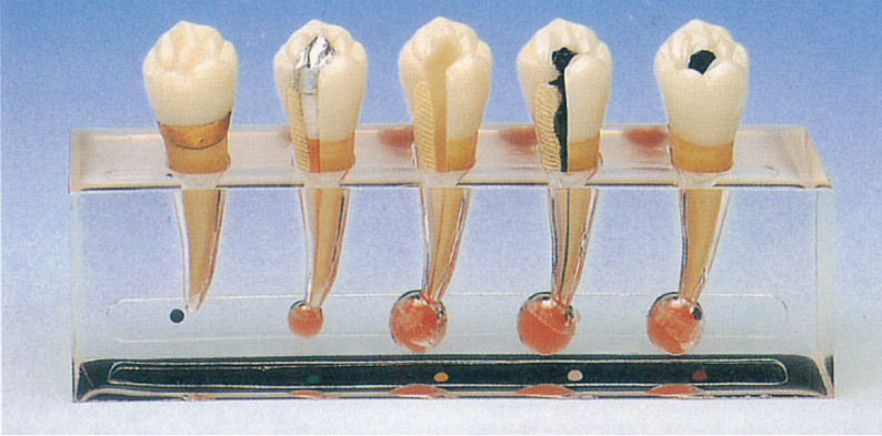 Clinical Pathology Model of Endodontics includes 5 Parts for Clinic Training