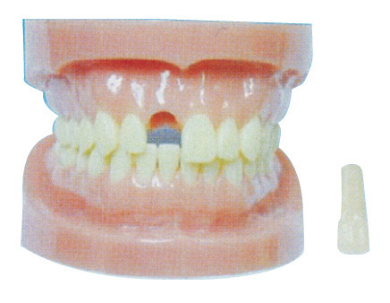 Detachable Teeth Model WIthout Root for Hospitals And Dental Prevention Training