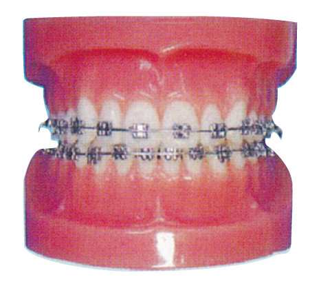 Orthodontic Human Teeth Model for Hospitals And Dental Hospital Training