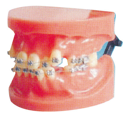 Dislocation Fixed Orthodontic Model For Medical College And Dental Hospital Training